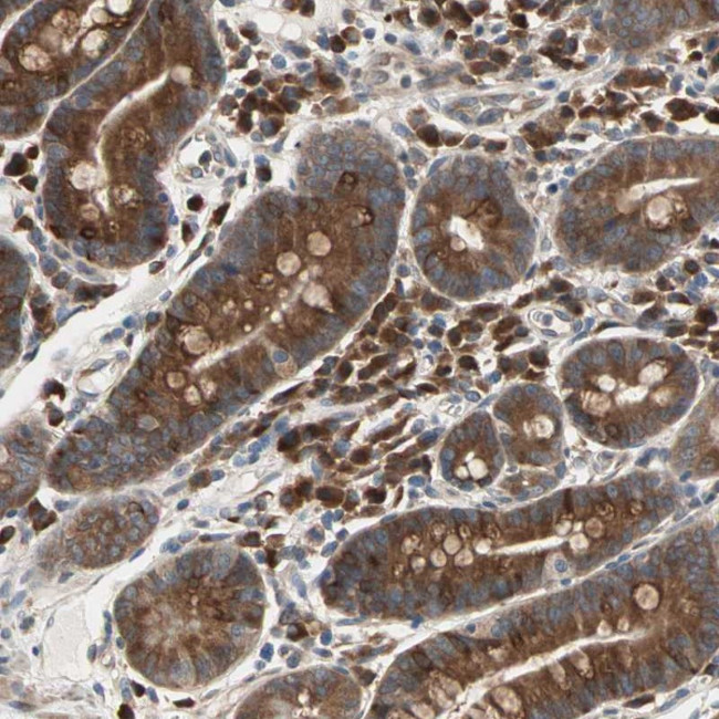 SAR1A Antibody in Immunohistochemistry (Paraffin) (IHC (P))
