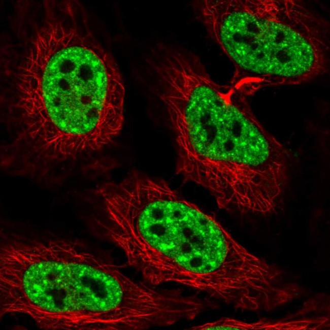 MKX Antibody in Immunocytochemistry (ICC/IF)
