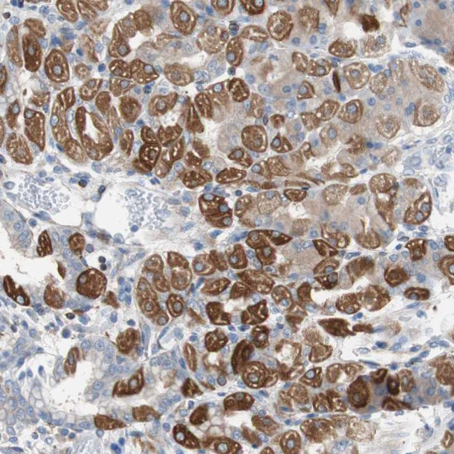PBXIP1 Antibody in Immunohistochemistry (Paraffin) (IHC (P))