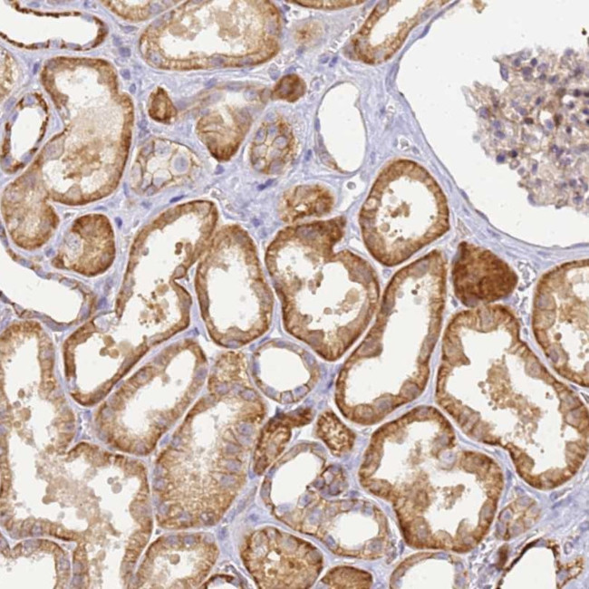 YY1AP1 Antibody in Immunohistochemistry (Paraffin) (IHC (P))