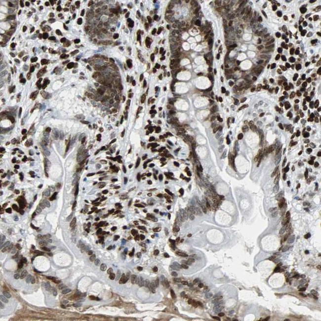 ZNF131 Antibody in Immunohistochemistry (Paraffin) (IHC (P))