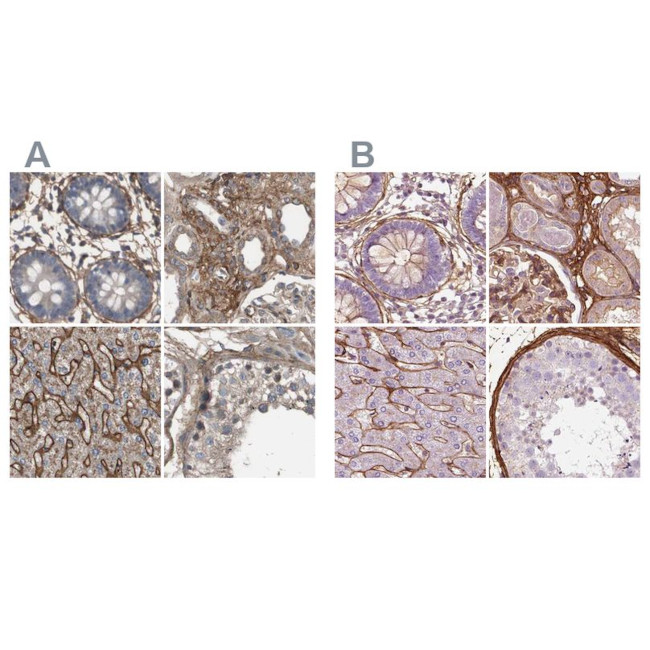 COL6A2 Antibody in Immunohistochemistry (IHC)