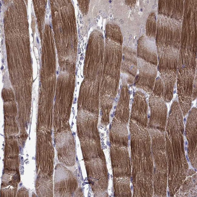 Titin Antibody in Immunohistochemistry (Paraffin) (IHC (P))