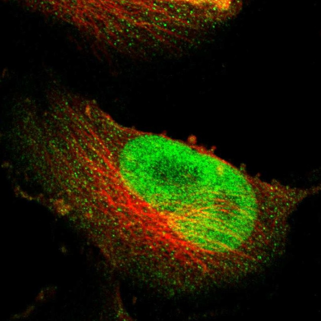 NFRKB Antibody in Immunocytochemistry (ICC/IF)