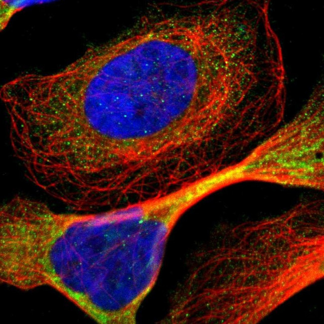 ADNP2 Antibody in Immunocytochemistry (ICC/IF)