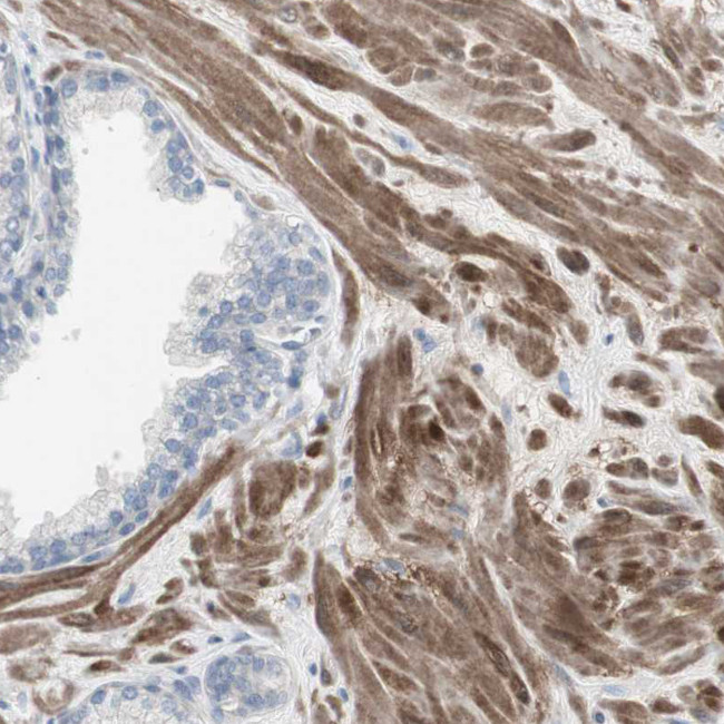 DMPK Antibody in Immunohistochemistry (Paraffin) (IHC (P))
