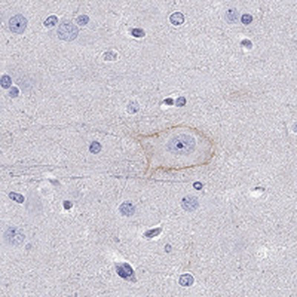 CDH9 Antibody in Immunohistochemistry (IHC)