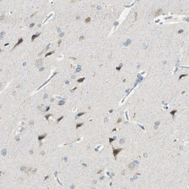 PCDHB15 Antibody in Immunohistochemistry (IHC)