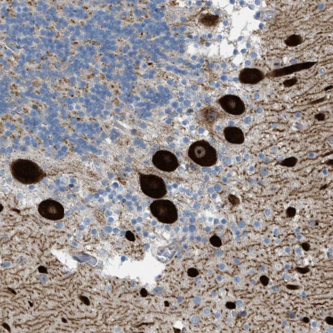 SERCA3 ATPase Antibody in Immunohistochemistry (Paraffin) (IHC (P))