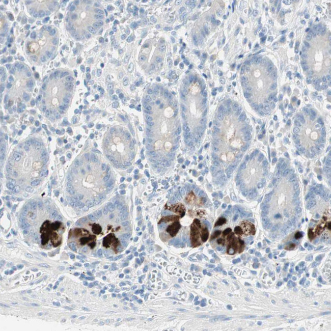 SULT1C2 Antibody in Immunohistochemistry (Paraffin) (IHC (P))