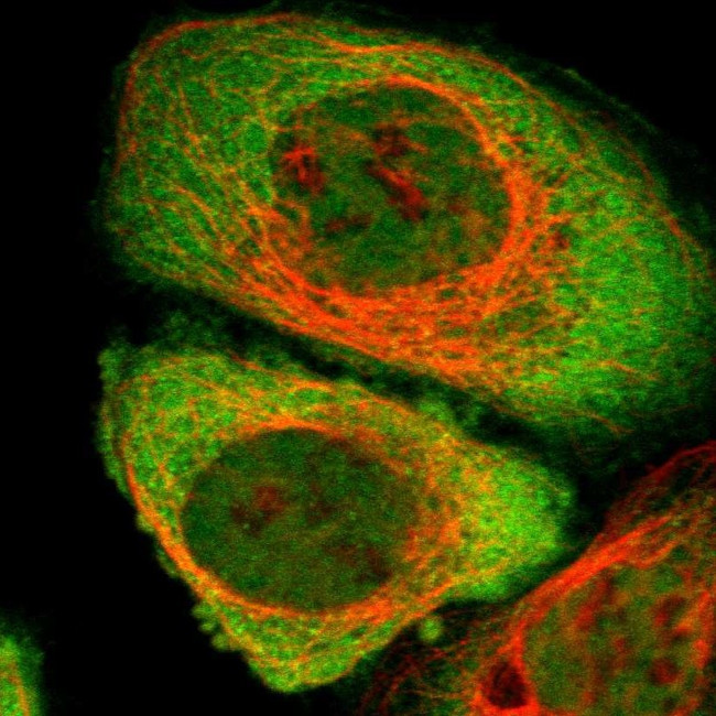 CYTIP Antibody in Immunocytochemistry (ICC/IF)