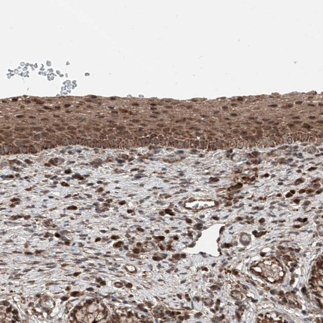ZNF690 Antibody in Immunohistochemistry (IHC)