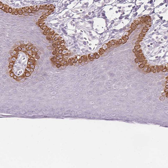 SCTR Antibody in Immunohistochemistry (Paraffin) (IHC (P))