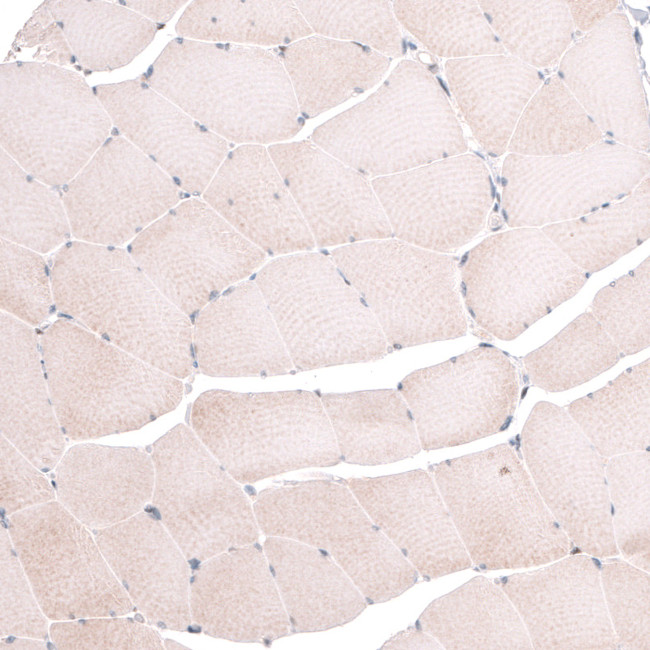 TSPAN13 Antibody in Immunohistochemistry (IHC)