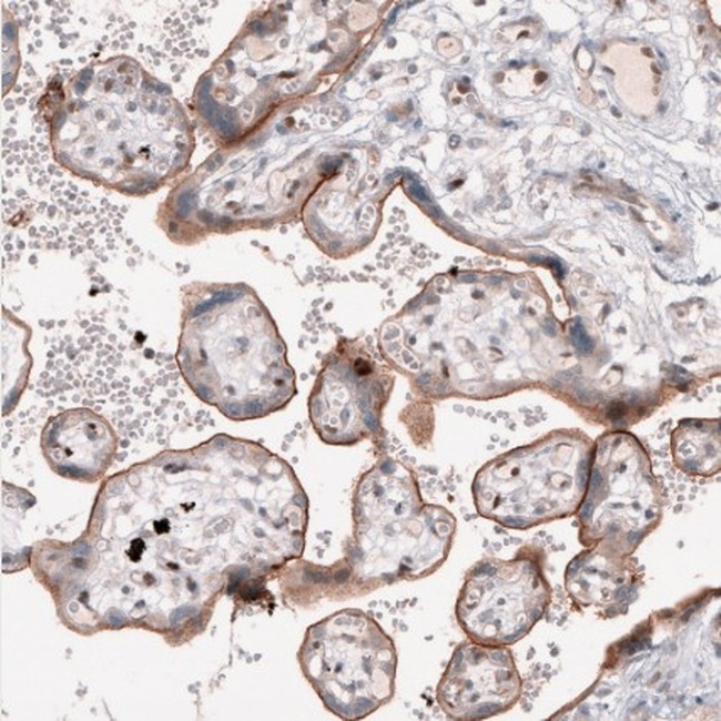 TSPAN13 Antibody in Immunohistochemistry (IHC)