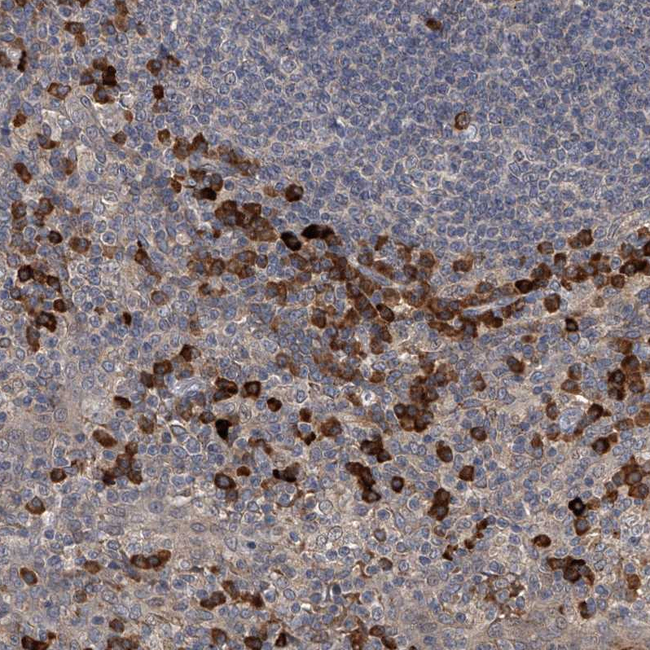SPOCK1 Antibody in Immunohistochemistry (Paraffin) (IHC (P))