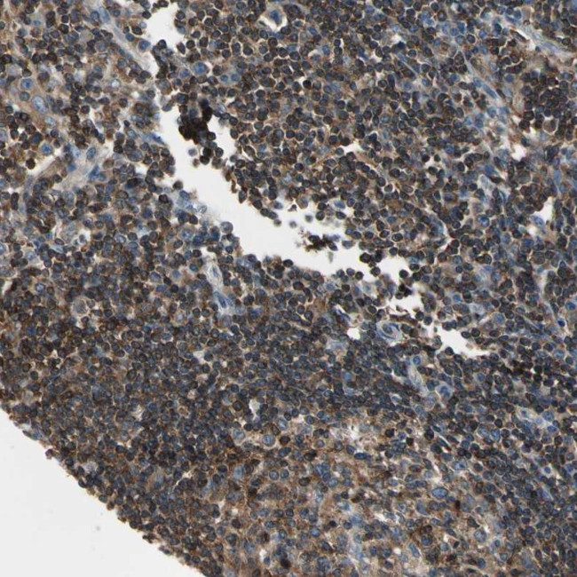 CAPZA2 Antibody in Immunohistochemistry (Paraffin) (IHC (P))