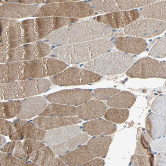 XYLT1 Antibody in Immunohistochemistry (Paraffin) (IHC (P))