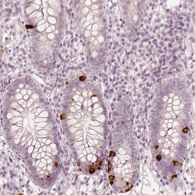 NPSR1 Antibody in Immunohistochemistry (Paraffin) (IHC (P))
