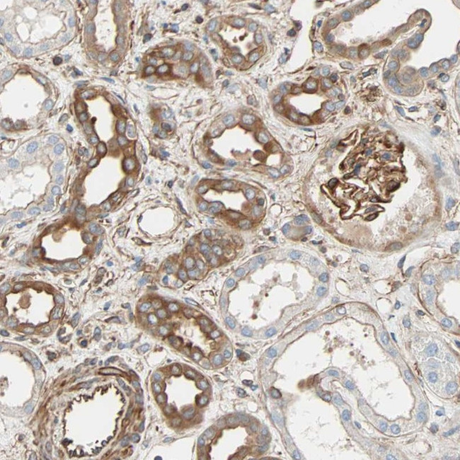GALNT10 Antibody in Immunohistochemistry (Paraffin) (IHC (P))