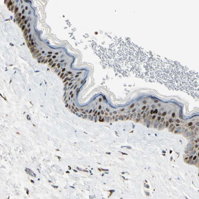 IP6K2 Antibody in Immunohistochemistry (IHC)