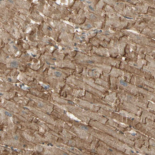 Alpha Sarcoglycan Antibody in Immunohistochemistry (Paraffin) (IHC (P))