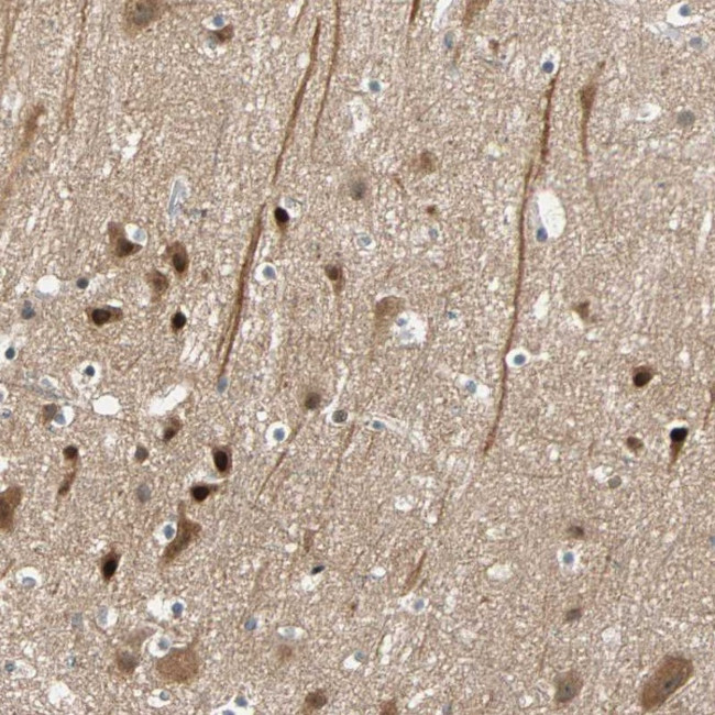 HECW1 Antibody in Immunohistochemistry (Paraffin) (IHC (P))
