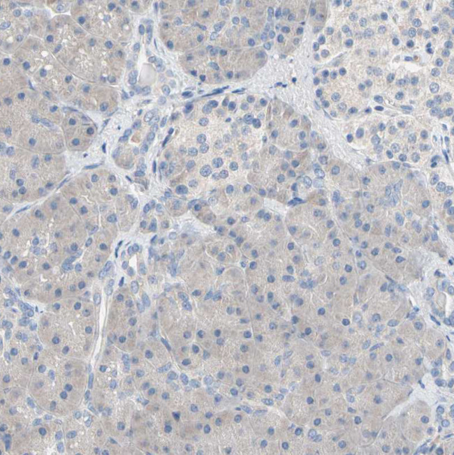 BBOX1 Antibody in Immunohistochemistry (Paraffin) (IHC (P))