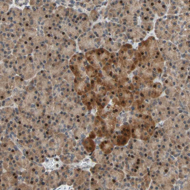 HECW1 Antibody in Immunohistochemistry (Paraffin) (IHC (P))