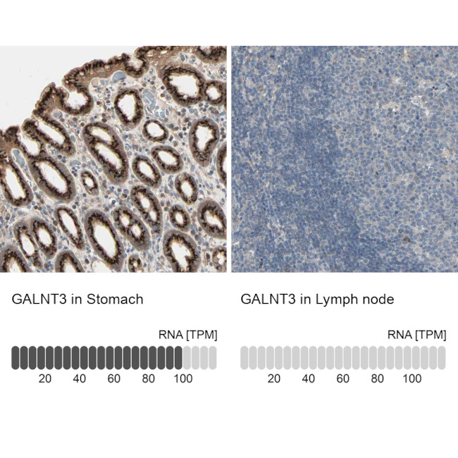 GALNT3 Antibody