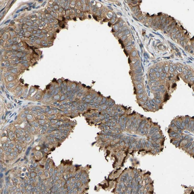 MGRN1 Antibody in Immunohistochemistry (Paraffin) (IHC (P))