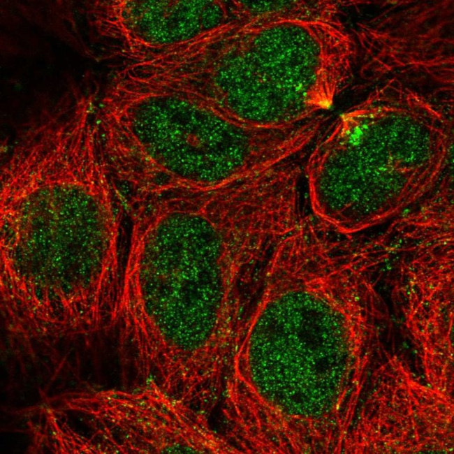 CaMKV Antibody in Immunocytochemistry (ICC/IF)