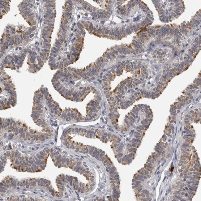 CDK20 Antibody in Immunohistochemistry (IHC)
