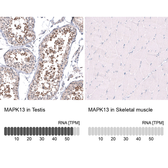 SAPK4 Antibody in Immunohistochemistry (Paraffin) (IHC (P))