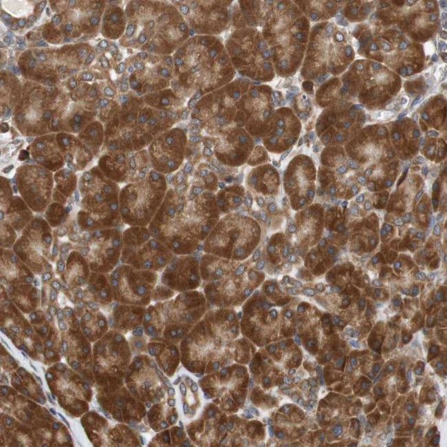 AUP1 Antibody in Immunohistochemistry (Paraffin) (IHC (P))