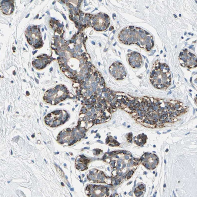 NIM1 Antibody in Immunohistochemistry (Paraffin) (IHC (P))