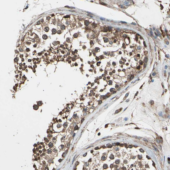 CCP2 Antibody in Immunohistochemistry (Paraffin) (IHC (P))
