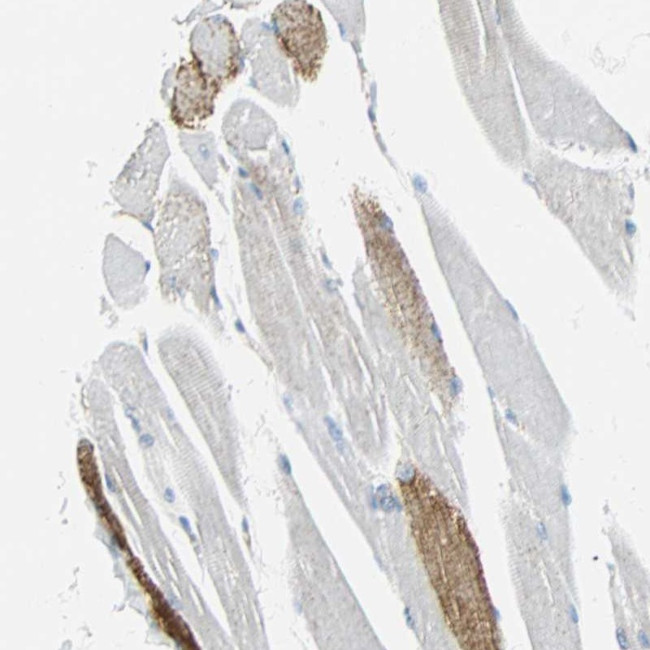 VPS9D1 Antibody in Immunohistochemistry (Paraffin) (IHC (P))