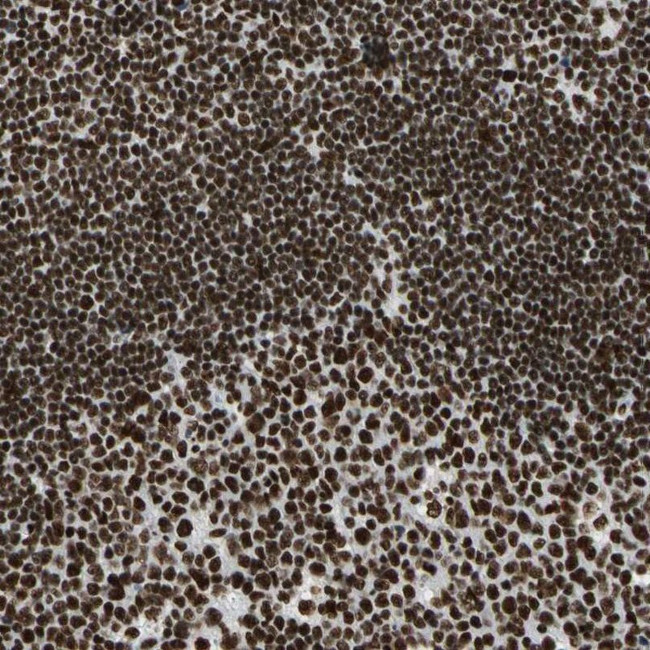 CCAR1 Antibody in Immunohistochemistry (IHC)