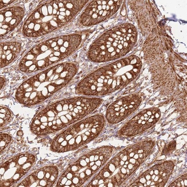 MRPS6 Antibody in Immunohistochemistry (Paraffin) (IHC (P))