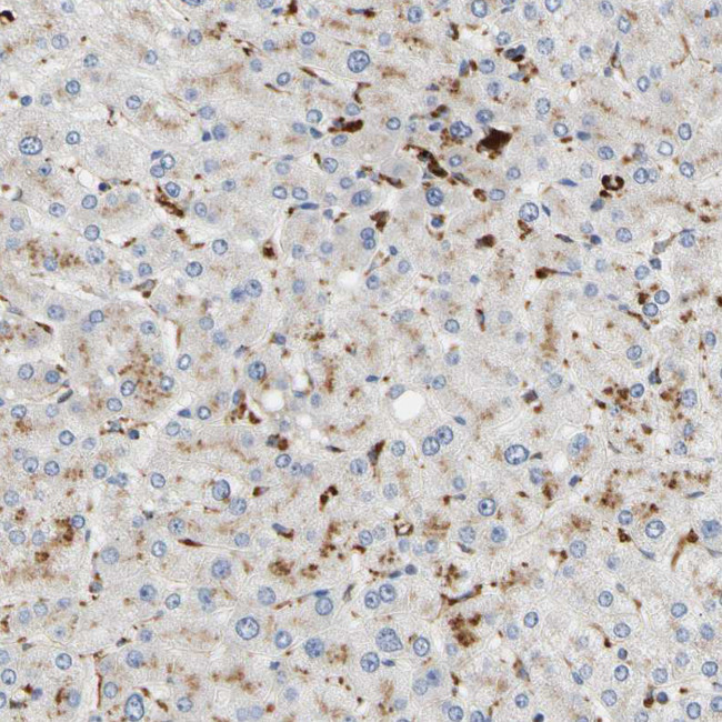 CECR1 Antibody in Immunohistochemistry (Paraffin) (IHC (P))