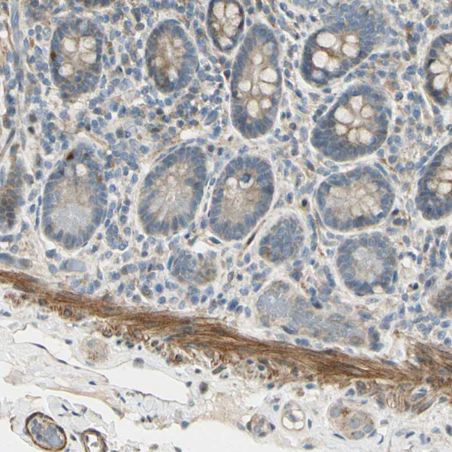 P4HA3 Antibody in Immunohistochemistry (Paraffin) (IHC (P))