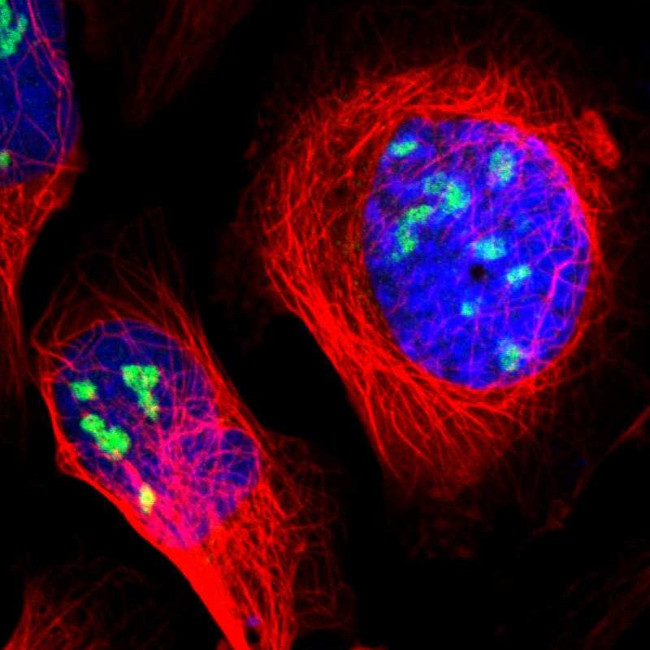 ZSCAN1 Antibody in Immunocytochemistry (ICC/IF)