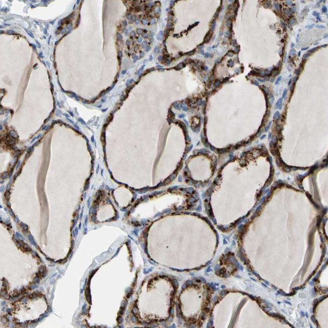 RETSAT Antibody in Immunohistochemistry (Paraffin) (IHC (P))