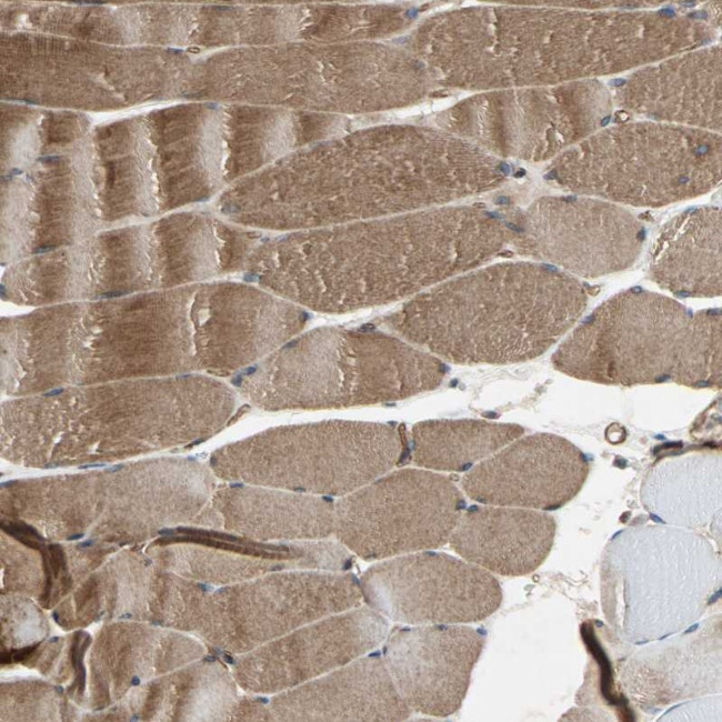 XYLT1 Antibody in Immunohistochemistry (Paraffin) (IHC (P))