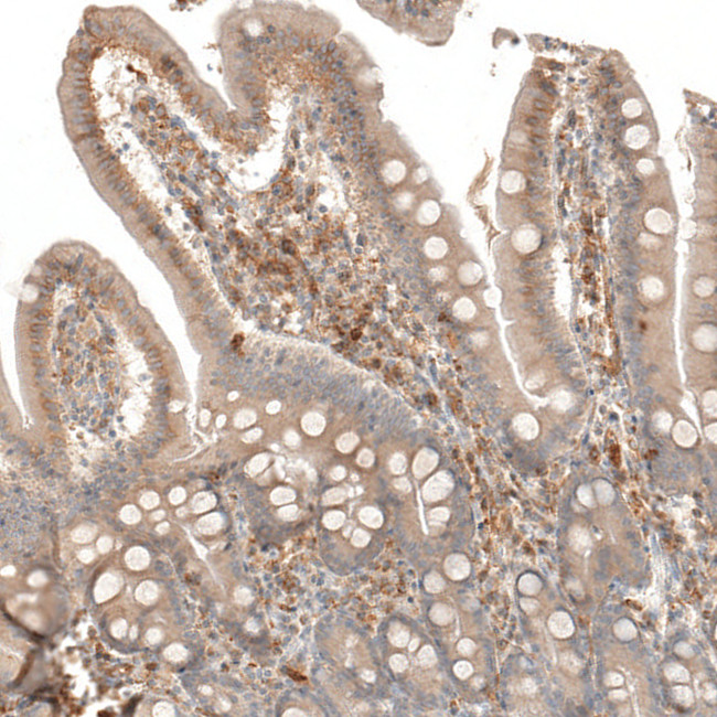 VISTA Antibody in Immunohistochemistry (Paraffin) (IHC (P))