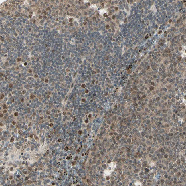 GTF3A Antibody in Immunohistochemistry (IHC)