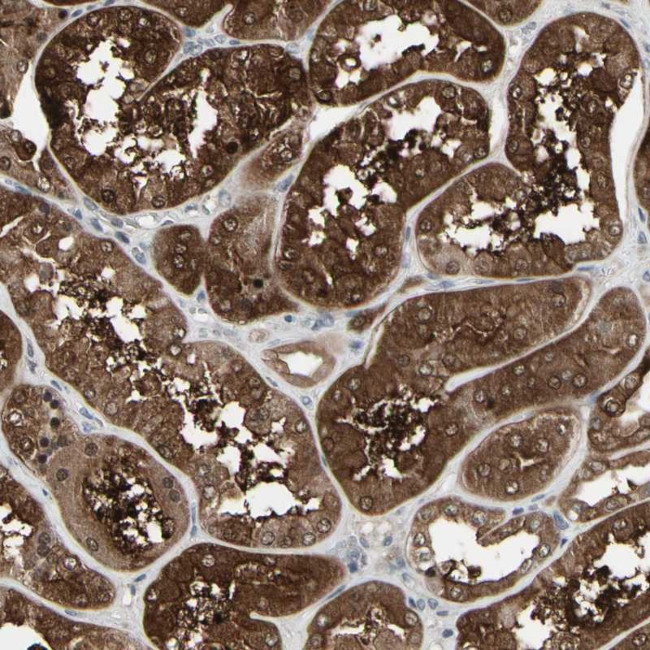 IGFBP6 Antibody in Immunohistochemistry (Paraffin) (IHC (P))