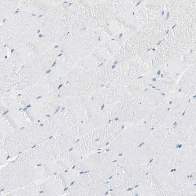 CEL Antibody in Immunohistochemistry (Paraffin) (IHC (P))