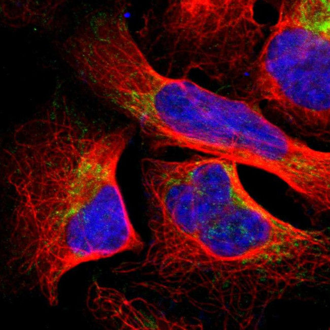 SFXN3 Antibody in Immunocytochemistry (ICC/IF)